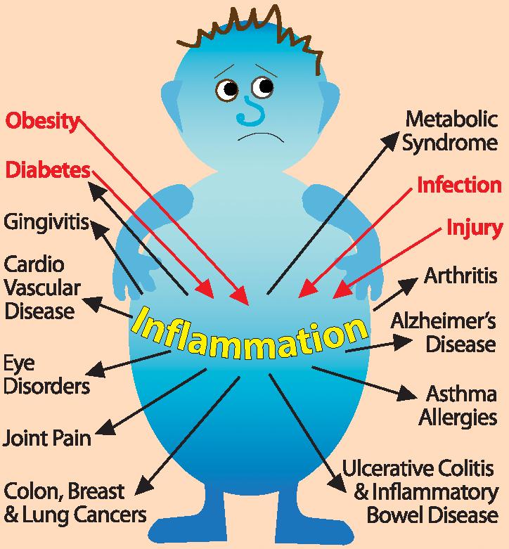 Effective inflammation reduction for better mobility